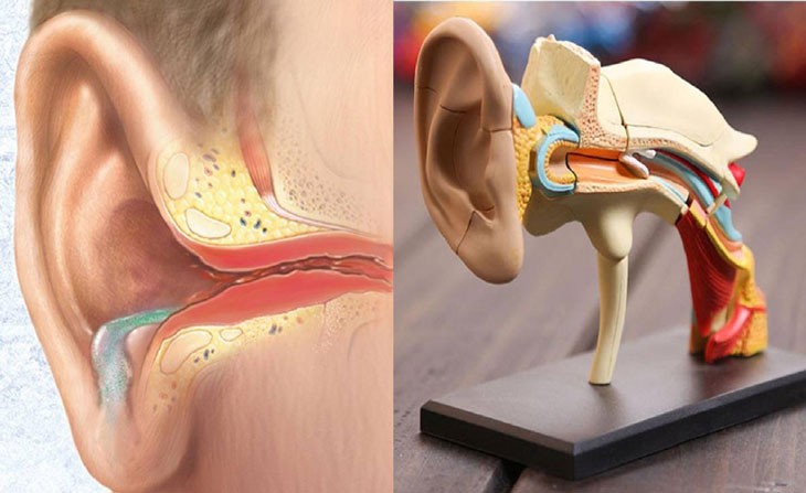 Bệnh Viêm tai giữa